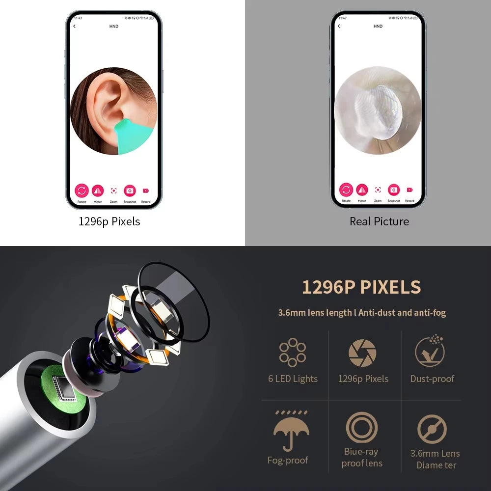 Smart Visual Ear Cleaner w/Camera w/6 LED Lights